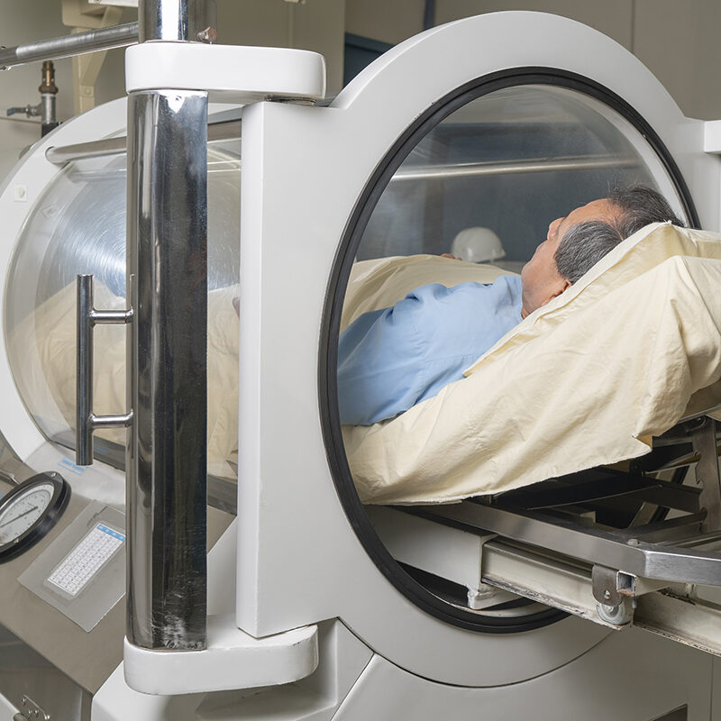 Man inside a cylindrical machine for hyperbaric treatment